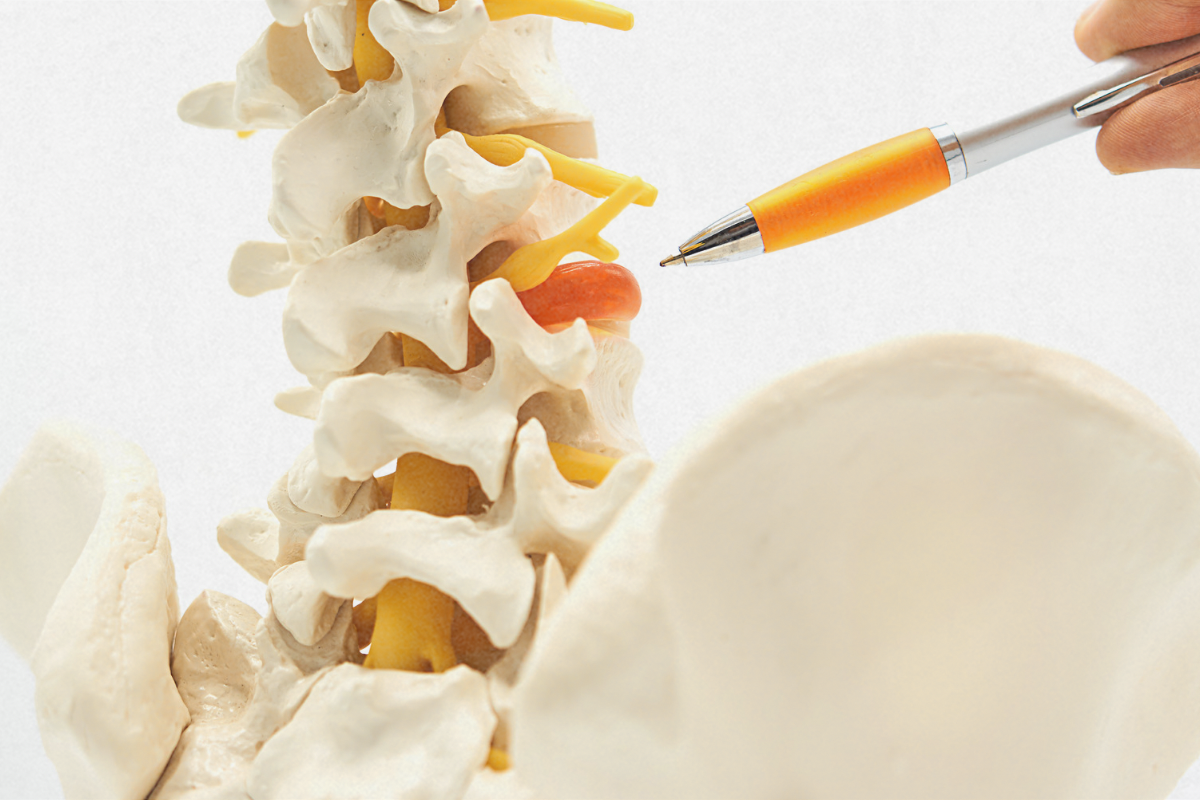 Descoperă puterea recuperării medicale: Soluții…